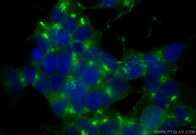 STMN2 Antibody in Immunocytochemistry (ICC/IF)
