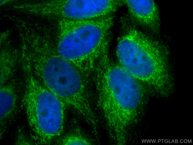 SDHB Antibody in Immunocytochemistry (ICC/IF)
