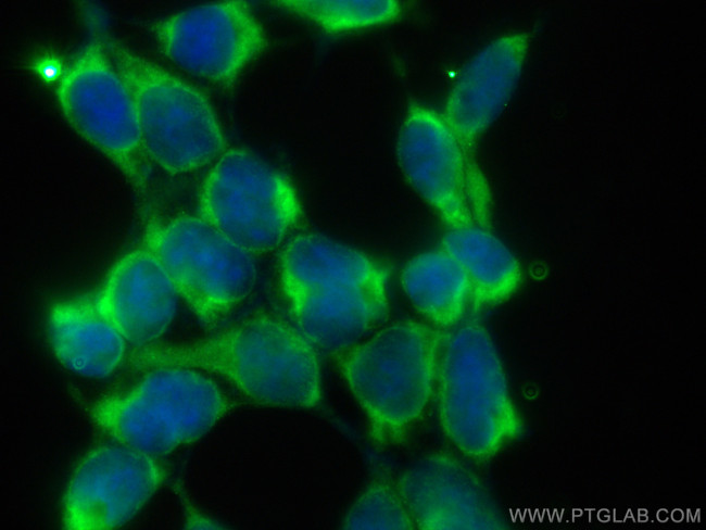 DENR Antibody in Immunocytochemistry (ICC/IF)