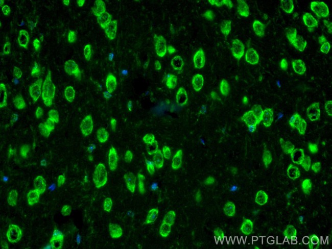 FABP3 Antibody in Immunohistochemistry (PFA fixed) (IHC (PFA))