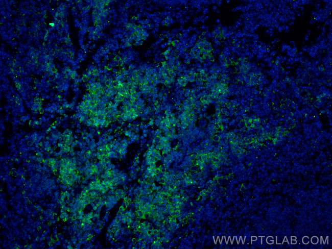 Lumican Antibody in Immunohistochemistry (PFA fixed) (IHC (PFA))