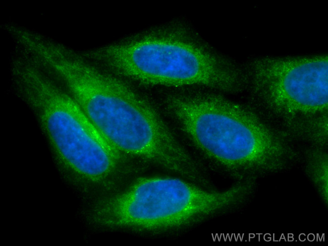PRDX4 Antibody in Immunocytochemistry (ICC/IF)