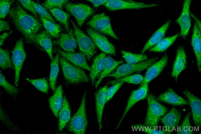 Cyclophilin A Antibody in Immunocytochemistry (ICC/IF)