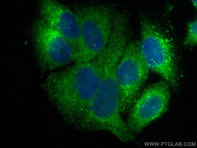 Ferritin light chain Antibody in Immunocytochemistry (ICC/IF)