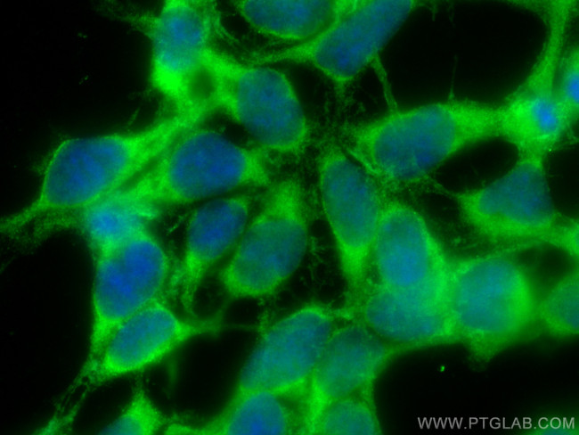 NIPSNAP3A Antibody in Immunocytochemistry (ICC/IF)