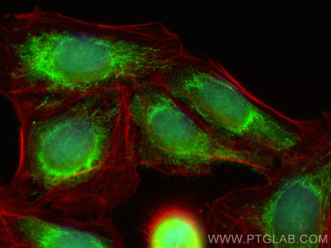 GTPBP3 Antibody in Immunocytochemistry (ICC/IF)