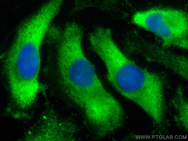 HPS3 Antibody in Immunocytochemistry (ICC/IF)