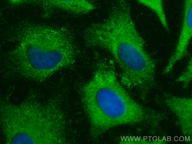 TRIP10 Antibody in Immunocytochemistry (ICC/IF)
