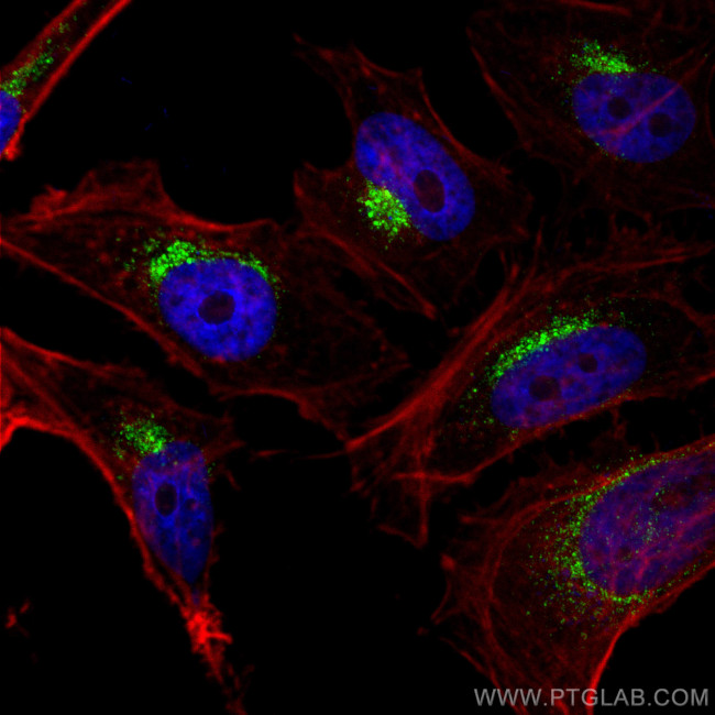 PSAP Antibody in Immunocytochemistry (ICC/IF)