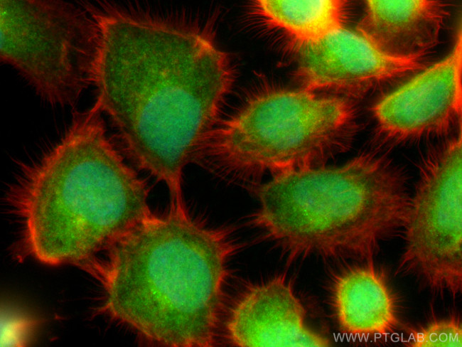 Cystatin B Antibody in Immunocytochemistry (ICC/IF)