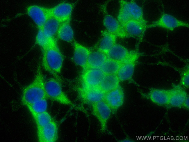 EIF3E Antibody in Immunocytochemistry (ICC/IF)