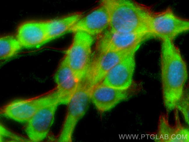 MYL3 Antibody in Immunocytochemistry (ICC/IF)