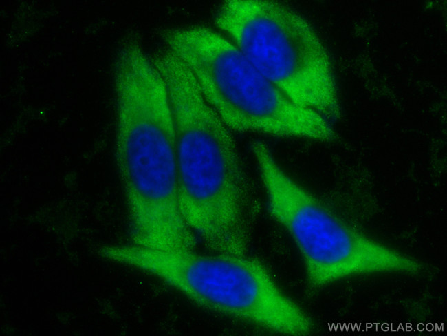 YWHAB Antibody in Immunocytochemistry (ICC/IF)