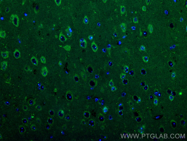 CRH/CRF Antibody in Immunohistochemistry (PFA fixed) (IHC (PFA))