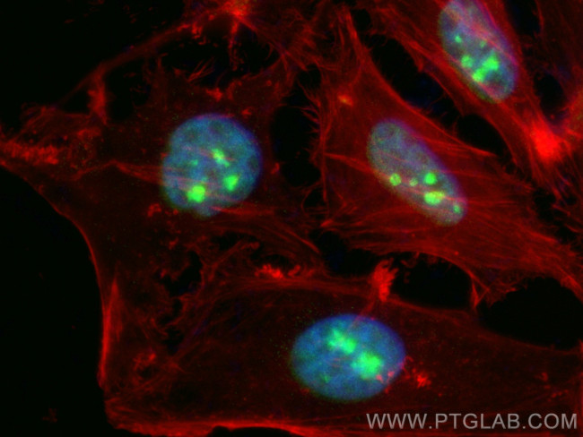 SUB1 Antibody in Immunocytochemistry (ICC/IF)