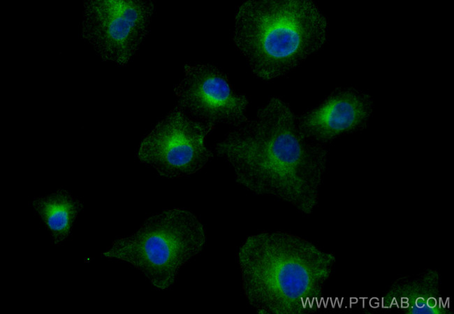 RTN4/NOGO Antibody in Immunocytochemistry (ICC/IF)