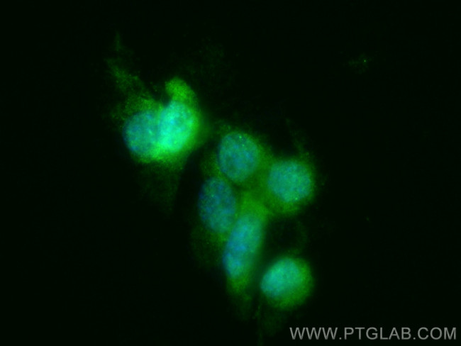Cofilin Antibody in Immunocytochemistry (ICC/IF)