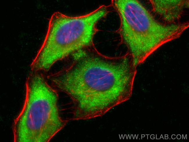 CSN2 Antibody in Immunocytochemistry (ICC/IF)
