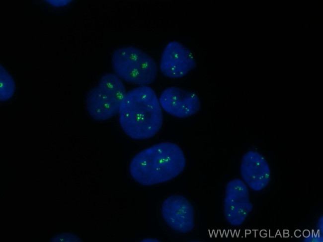 TCOF1 Antibody in Immunocytochemistry (ICC/IF)