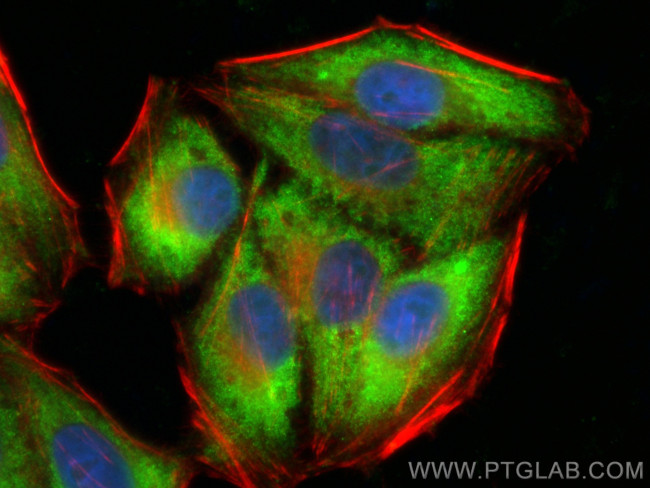 CDK5RAP3 Antibody in Immunocytochemistry (ICC/IF)