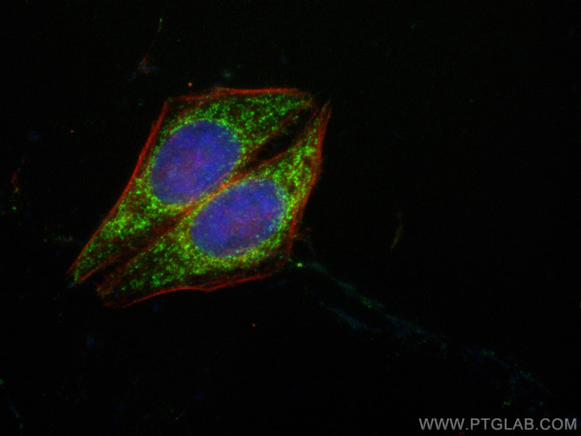 AK2 Antibody in Immunocytochemistry (ICC/IF)