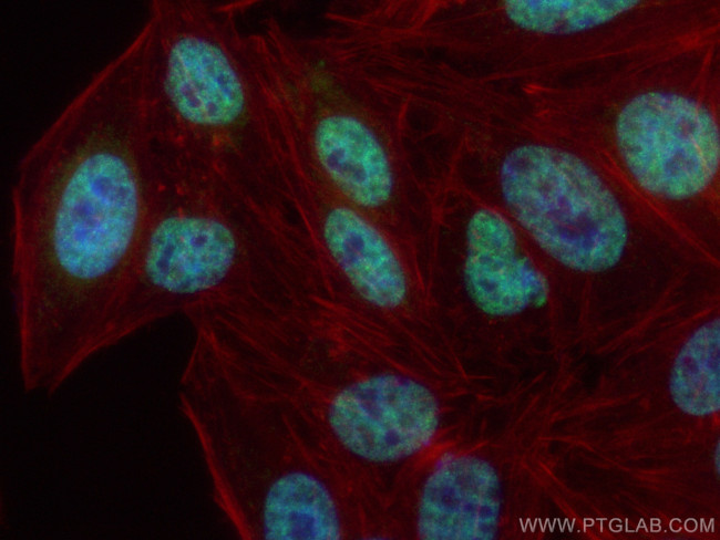 POLR3K Antibody in Immunocytochemistry (ICC/IF)