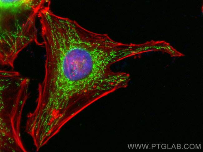 MMAB Antibody in Immunocytochemistry (ICC/IF)