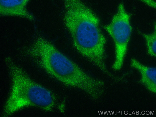 EIF5 Antibody in Immunocytochemistry (ICC/IF)