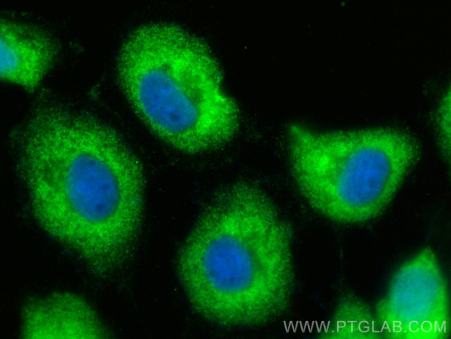 SUMF2 Antibody in Immunocytochemistry (ICC/IF)
