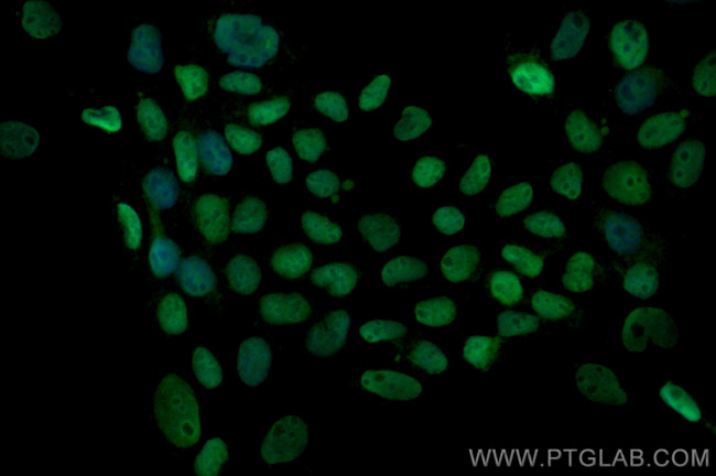 MCM7 Antibody in Immunocytochemistry (ICC/IF)