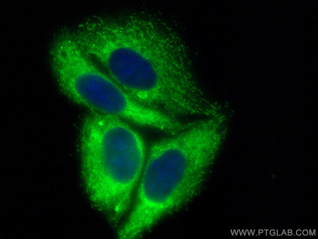 EIF2A/CDA02 Antibody in Immunocytochemistry (ICC/IF)