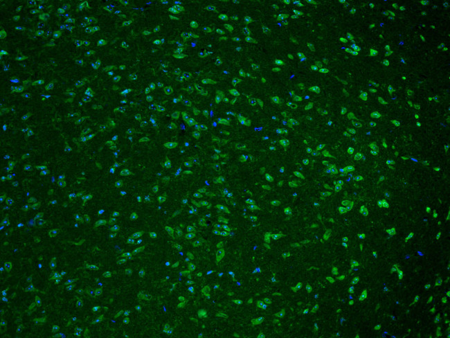Cathepsin K Antibody in Immunohistochemistry (Paraffin) (IHC (P))