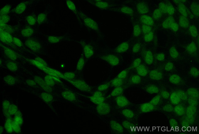 SUMO2/3 Antibody in Immunocytochemistry (ICC/IF)