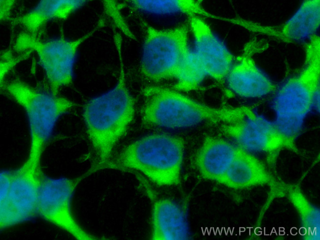 ATG3 Antibody in Immunocytochemistry (ICC/IF)