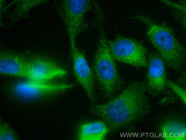 ATG12 Antibody in Immunocytochemistry (ICC/IF)
