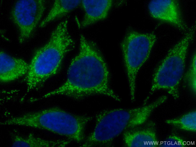 ECHS1 Antibody in Immunocytochemistry (ICC/IF)