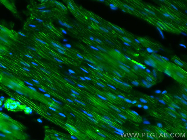 Alpha Actinin Antibody in Immunohistochemistry (PFA fixed) (IHC (PFA))
