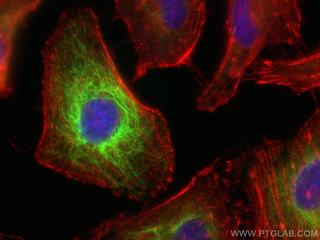 Keratin 81 Antibody in Immunocytochemistry (ICC/IF)