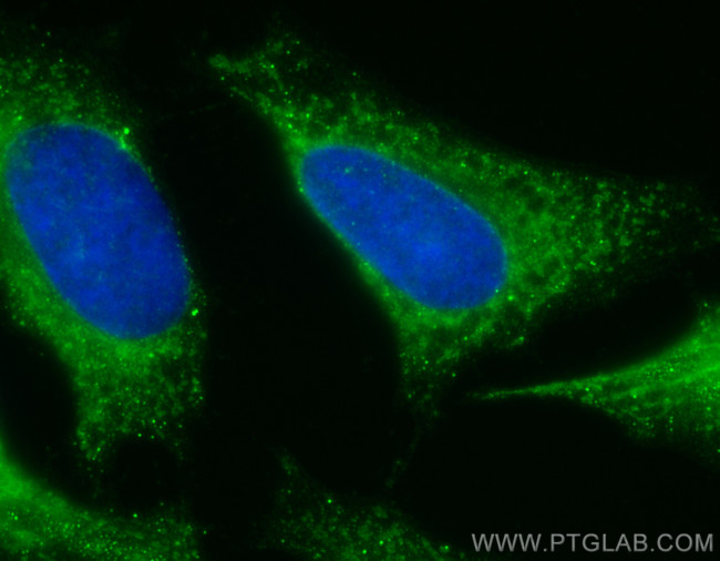 FH Antibody in Immunocytochemistry (ICC/IF)