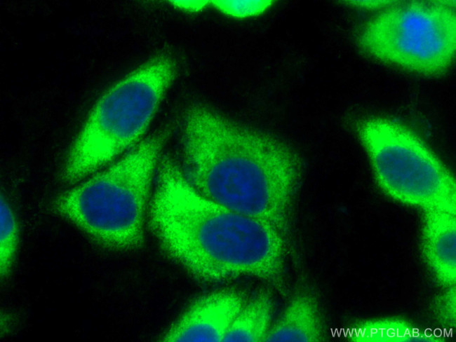 EEF1A1 Antibody in Immunocytochemistry (ICC/IF)