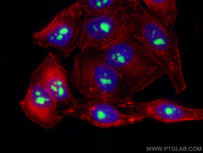 UTP14A Antibody in Immunocytochemistry (ICC/IF)