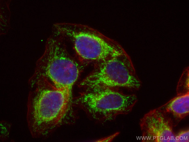 TIMM9 Antibody in Immunocytochemistry (ICC/IF)