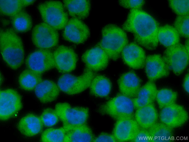 DGKA Antibody in Immunocytochemistry (ICC/IF)