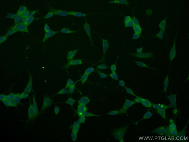 MED15 Antibody in Immunocytochemistry (ICC/IF)