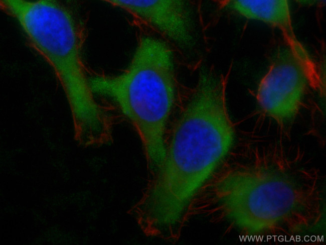 RGS5 Antibody in Immunocytochemistry (ICC/IF)