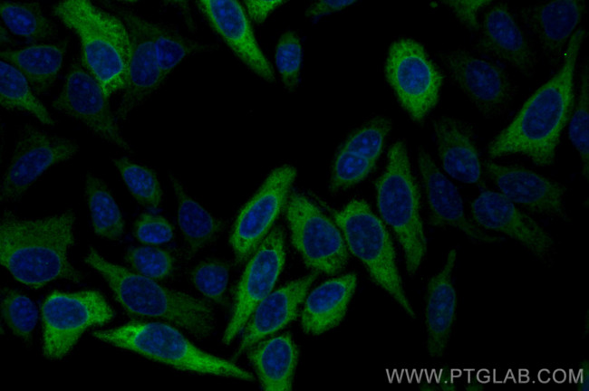 RRM2 Antibody in Immunocytochemistry (ICC/IF)