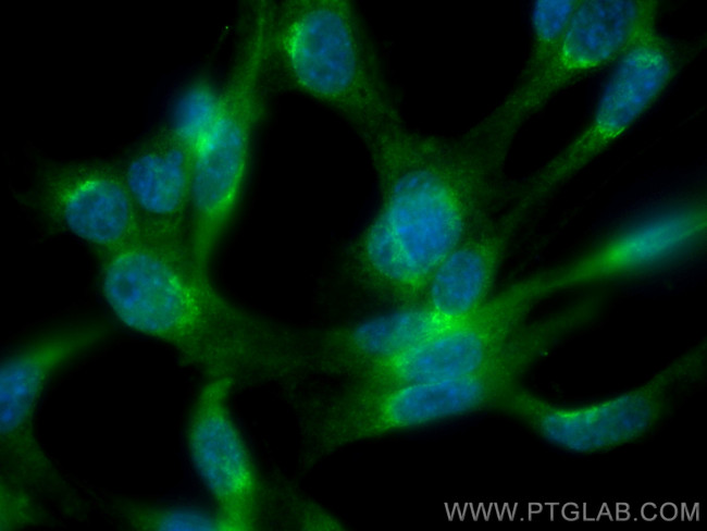 RAB1A Antibody in Immunocytochemistry (ICC/IF)