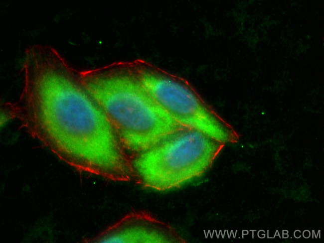TTC1 Antibody in Immunocytochemistry (ICC/IF)