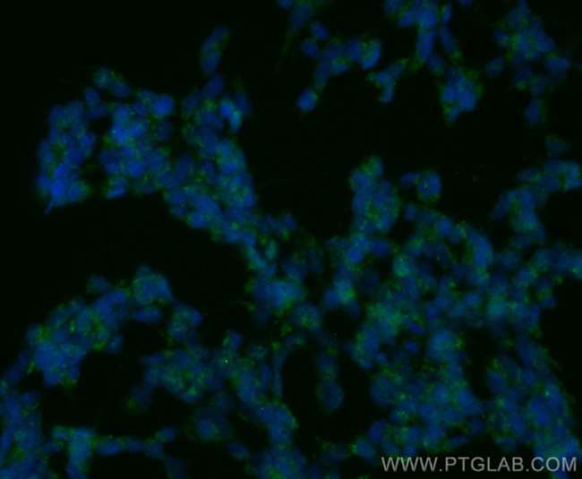 PARK7/DJ-1 Antibody in Immunocytochemistry (ICC/IF)