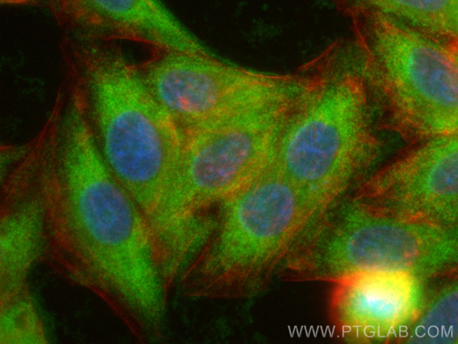DYNLT3 Antibody in Immunocytochemistry (ICC/IF)